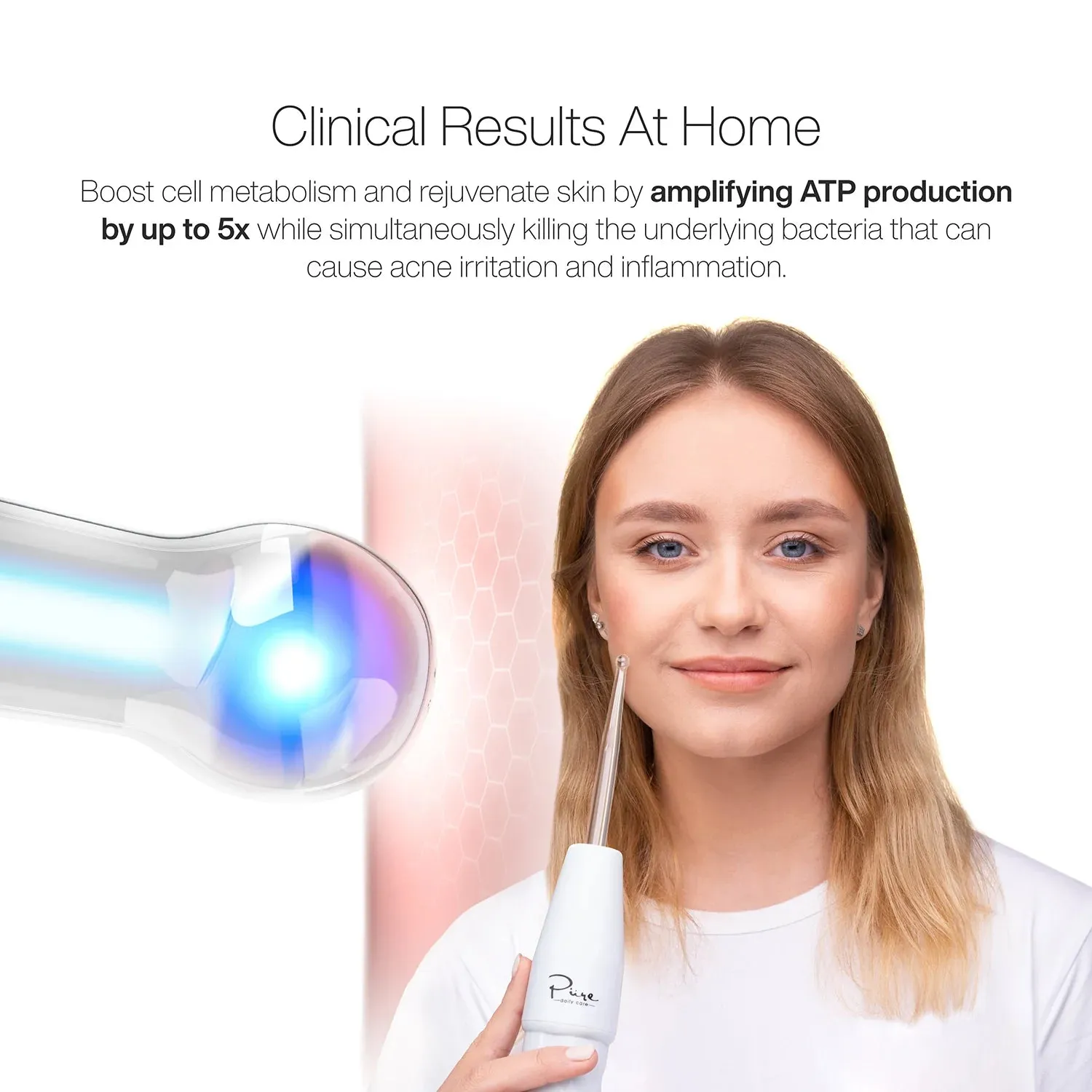 High Frequency Wand - Skin Therapy Wand: Tighten, Treat Acne, Reduce Wrinkles